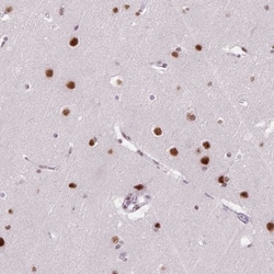 SNORC Antibody, Novus Biologicals 0.1mL; Unlabeled:Antibodies, Polyclonal